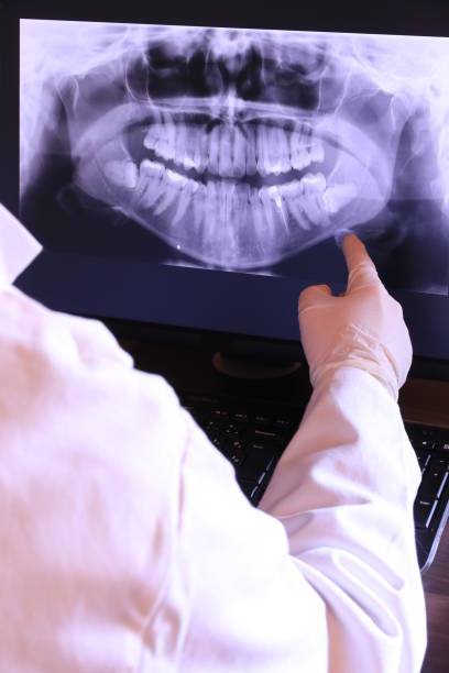 Best Emergency Treatment for Toothache in Buckley, WA